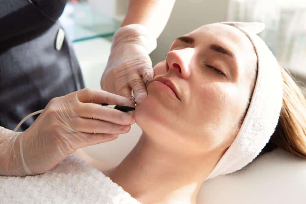 Hair removal using electrolysis to permanently remove unwanted hair at lucie oliver aesthetics in london.