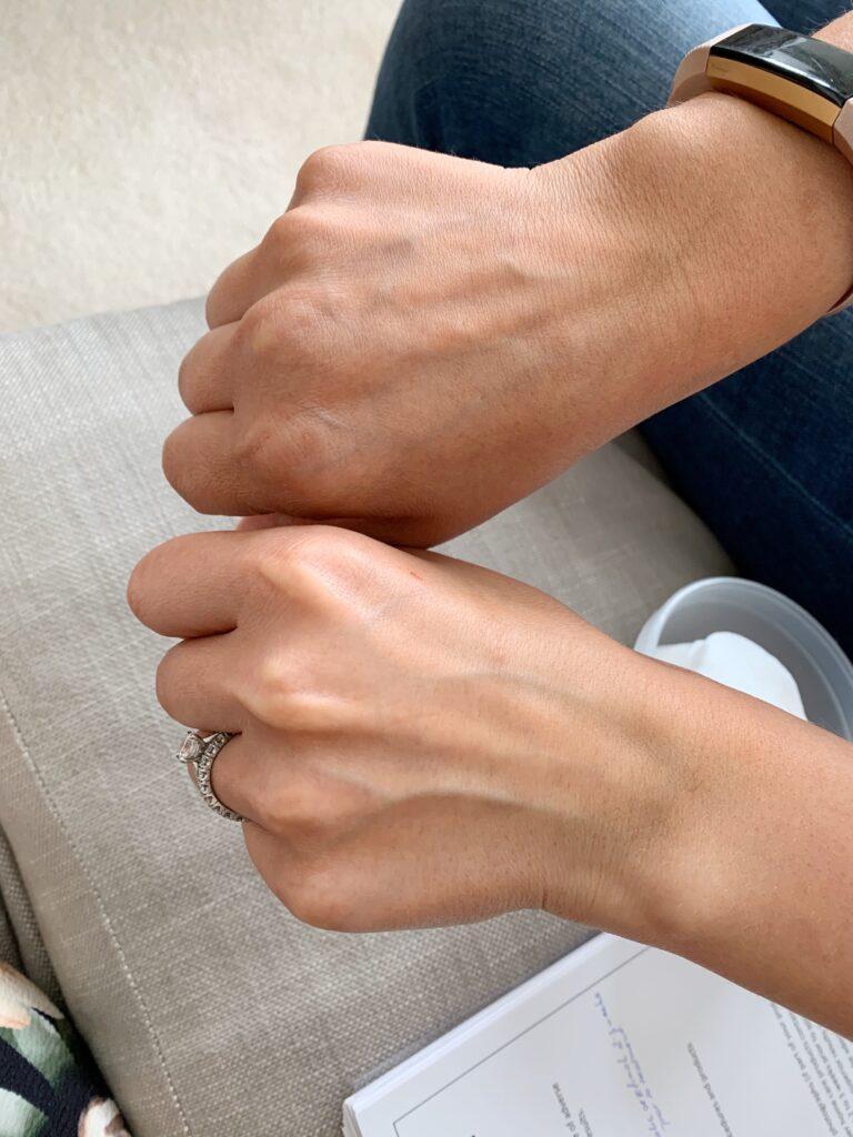 Acs 0083: lucie oliver aesthetics Hand treatment